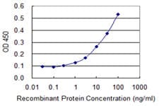 NIX / BNIP3L Antibody (clone 2E11)