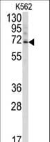 Polyclonal Rabbit anti-Human UBQLN3 Antibody (aa1-30, IHC, WB)