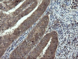 DOK7 Antibody (clone OTI1F7)