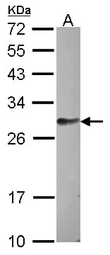 Polyclonal Rabbit anti-Human FAM122B Antibody (aa1-145, WB)