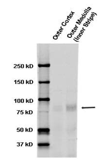 SCNN1A / ENaC Alpha Antibody (aa46-68, Atto 390)