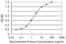 IHC-plus™ GSTM2 Antibody (clone 1E10)