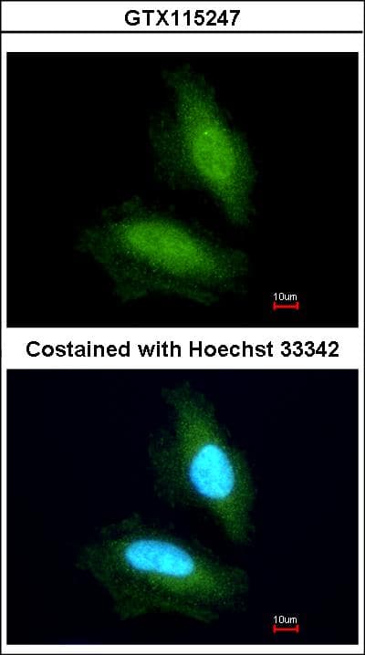 IHC-plus™ NPEPPS Antibody (aa328-648)