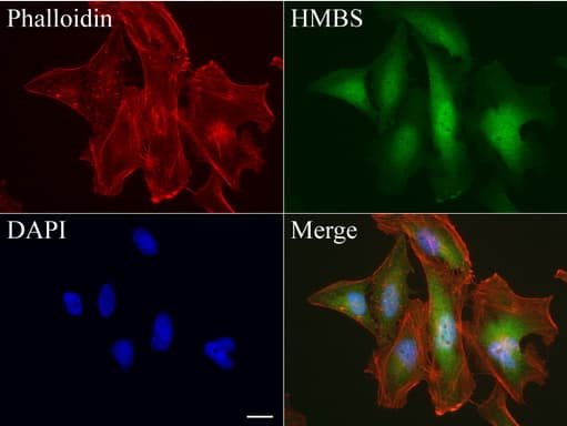 Monoclonal Mouse anti-Human HMBS / PBGD Antibody (clone UMAB144, Carrier-free, IHC, IF, WB)