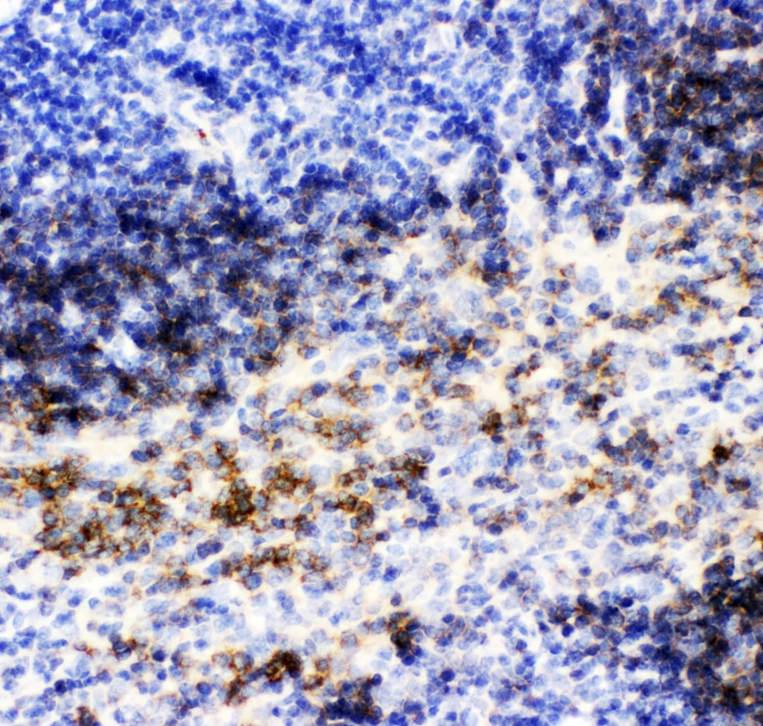 CD79B / CD79 Beta Antibody (aa29-229)
