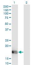 OMP Antibody (clone 2B7)