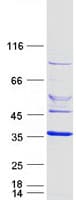 Human ELMOD2 Protein (Recombinant Myc-DDK (Flag))