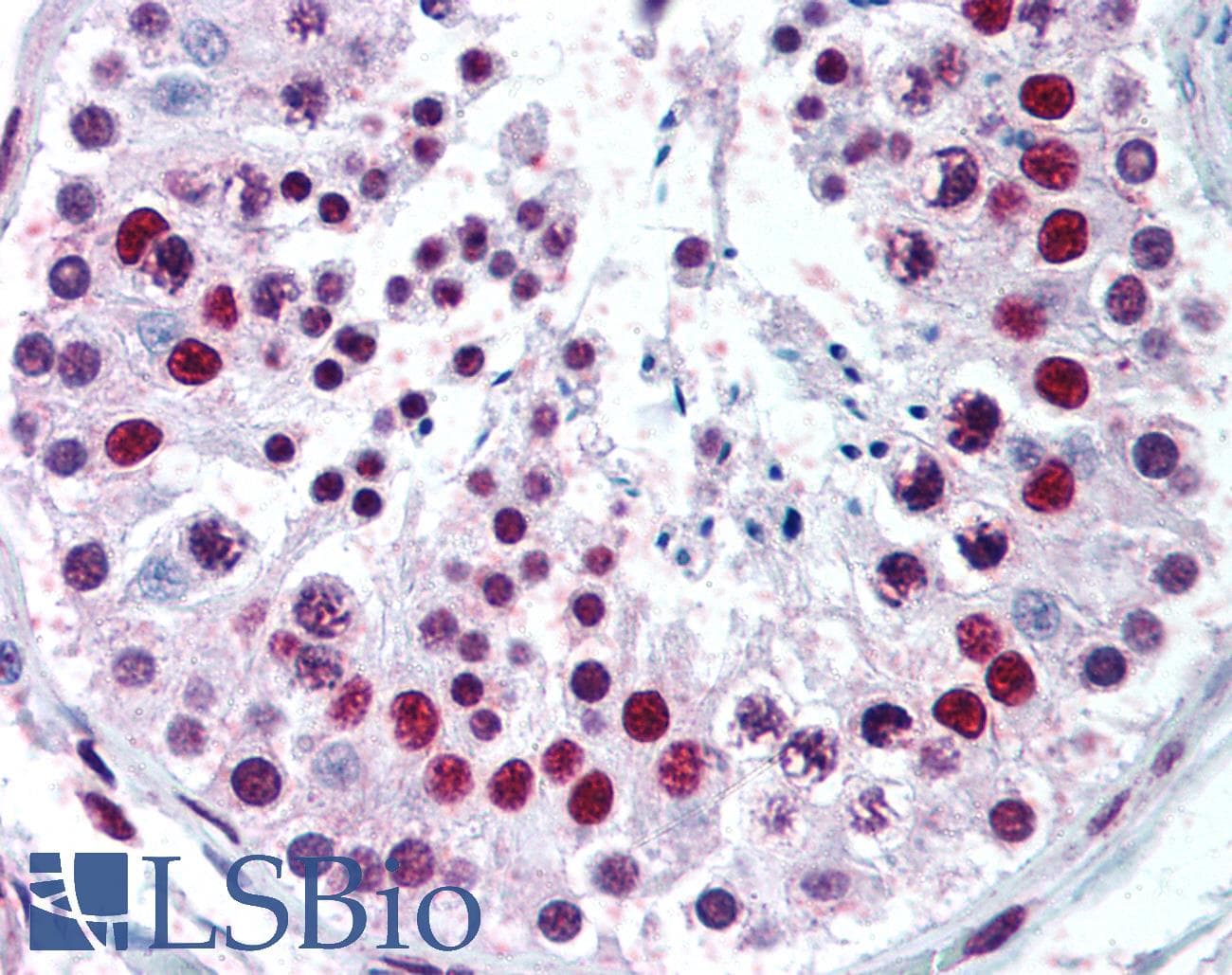 IHC-plus™ Polyclonal Rabbit anti-Human MECP2 Antibody (aa11-25, IHC, WB)