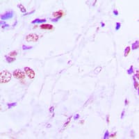 Polyclonal Rabbit anti-Human ATF2 Antibody (N-Terminus, IHC, WB)