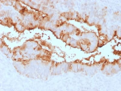 CA125 Antibody (clone OCA125/2349R)