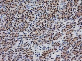 Monoclonal Mouse anti-Human MGLL / Monoacylglycerol Lipase Antibody (clone OTI1H1, IHC, IF, WB)