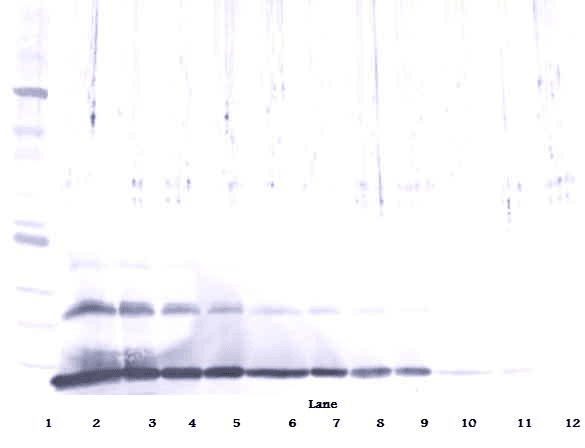 TGFB1 / TGF Beta 1 Antibody