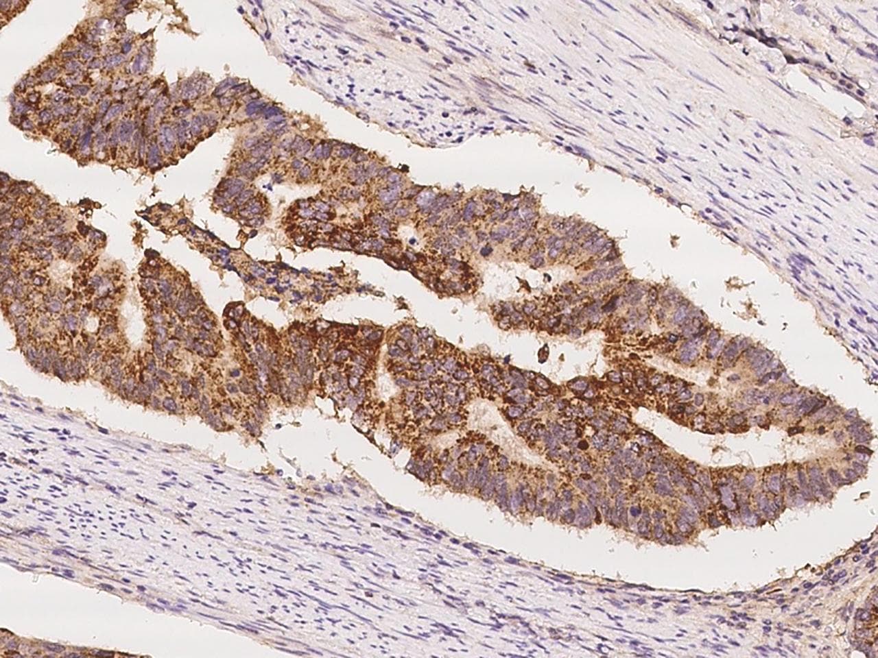 WNK3 / PRKWNK3 Antibody