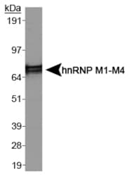 Nuclear Ribonucleoprotein M1/M2/M3/M4 Antibody (clone 1D8)