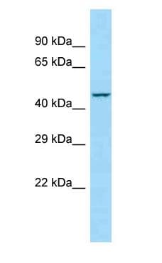 DNAM-1 / CD226 Antibody (aa265-314)