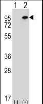 Polyclonal Rabbit anti-Human NSD3 / WHSC1L1 Antibody (aa188-217, WB)