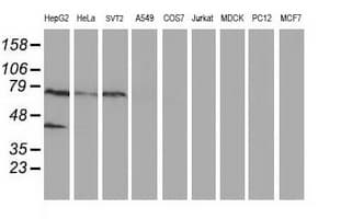Monoclonal Mouse anti-Human ANKRD53 Antibody (clone OTI1E1, IHC, IF, WB)