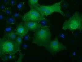 Monoclonal Mouse anti-Human KHK / Ketohexokinase Antibody (clone OTI4B8, IF, WB)