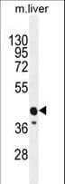 IHC-plus™ CACNG8 Antibody (aa90-119)
