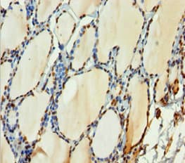 Polyclonal Rabbit anti-Human H2AFY / MACROH2A1 Antibody (IHC, WB)