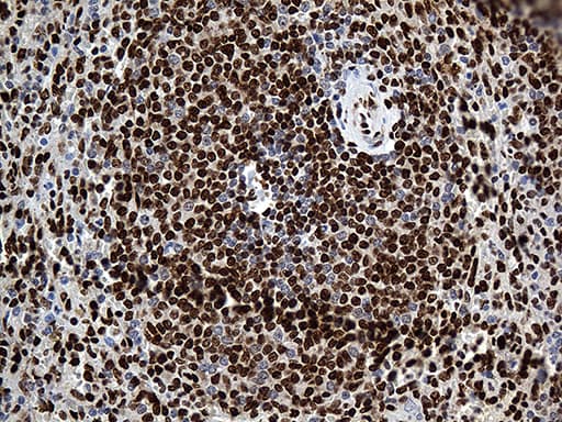 Monoclonal Mouse anti-Human PTBP3 / ROD1 Antibody (clone OTI5G7, aa300-552, IHC, WB)