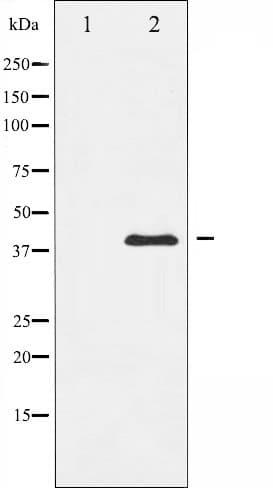 MAP2K1 / MKK1 / MEK1 Antibody