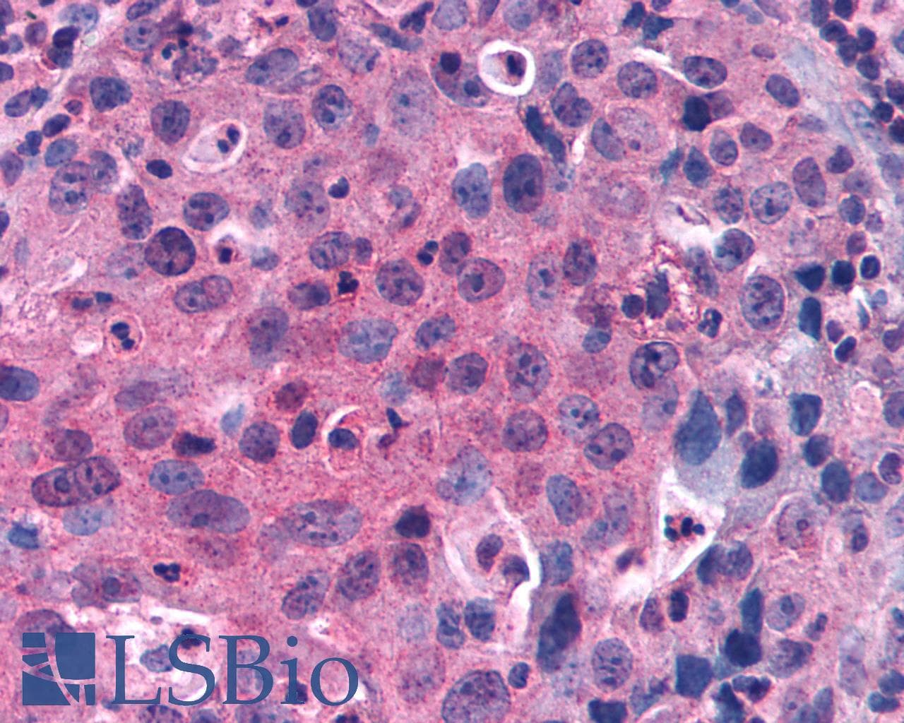 PathPlus™ Polyclonal Rabbit anti-Human GPRC5C Antibody (C-Terminus, IHC)
