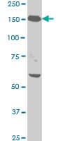 Monoclonal Mouse anti-Human NEFH / NF-H Antibody (clone 2E8, WB)