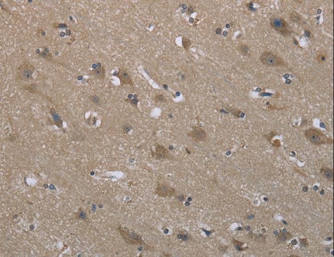 SYT3 / Synaptotagmin 3 Antibody