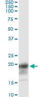 IHC-plus™ Monoclonal Mouse anti-Human CD247 / CD3 Zeta Antibody (clone 4A12-F6, IHC, WB)