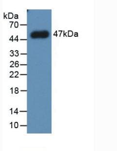 SERPINE1 / PAI-1 Antibody