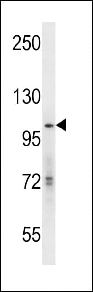 Polyclonal Rabbit anti-Human KAT2A / GCN5 Antibody (aa807-837, WB)