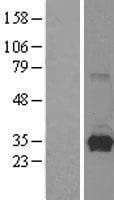 HPRT1 / HPRT Protein (Over-Expression Lysate Myc-DDK (Flag))