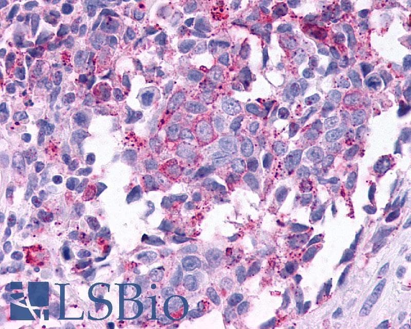 PathPlus™ Polyclonal Rabbit anti-Human GPBAR1 / TGR5 Antibody (C-Terminus, IHC)