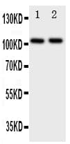 TJP3 / ZO3 Antibody (aa885-905)