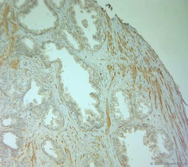 PLIN4 / S3-12 Antibody (aa1050-1100)