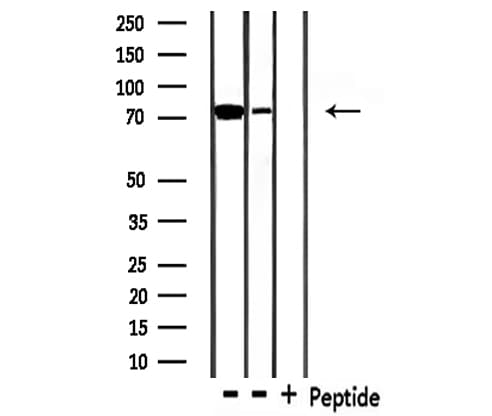 MAP3K3 / MEKK3 Antibody