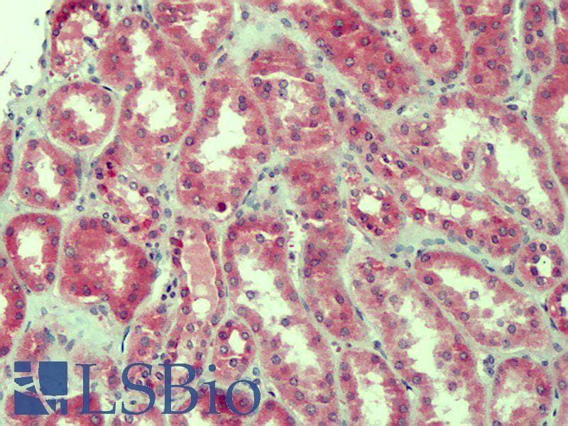 IHC-plus™ CLDN2 / Claudin 2 Antibody (aa135-164)