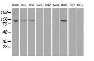 HK2 / Hexokinase 2 Antibody (clone OTI4C5)