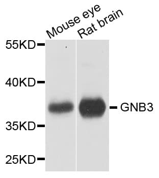 GNB3 Antibody