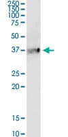 B1R / BDKRB1 Antibody (clone 3A2)