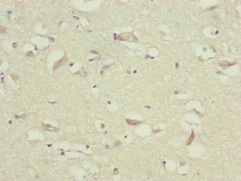 Polyclonal Rabbit anti-Human TTLL7 Antibody (IHC, WB)