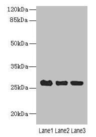 C10orf82 Antibody