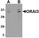 IHC-plus™ Polyclonal Rabbit anti-Human ORAI3 Antibody (IHC, IF, WB)