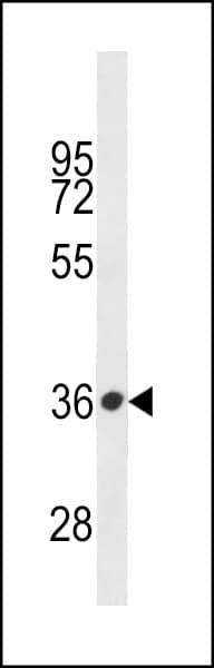 PRSS57 Antibody (aa225-254)