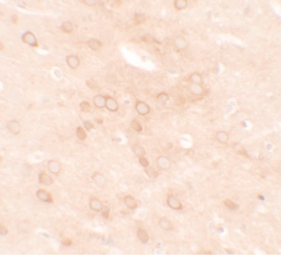 ER Alpha / Estrogen Receptor Antibody