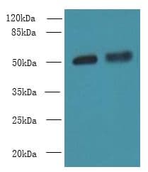IHC-plus™ CBX2 Antibody