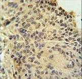 Polyclonal Rabbit anti-Human RSPO2 Antibody (aa190-218, IHC, WB)