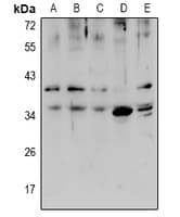 Polyclonal Rabbit anti-Human SLC39A1 Antibody (WB)