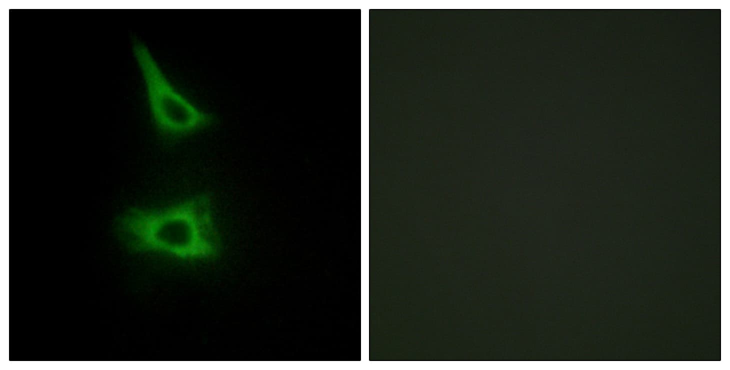 CDH17 / Cadherin 17 Antibody (aa341-390)